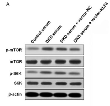 Phospho-mTOR (Ser2448) Antibody - Figure 4.