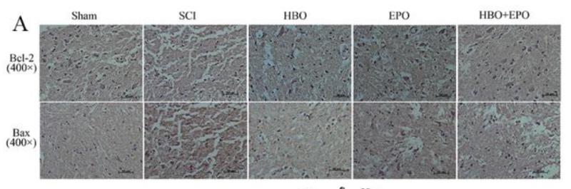 Bcl-2 Antibody - Figure 3 |Hyperbaric oxygen (HBO) and erythropoietin (EPO) enhance the expression of antiapoptosis protein Bcl-2 (B-cell lymphoma/leukemia 2 protein) and inhibit the expression of proapoptosis protein Bax (Bcl-2–associated X protein).