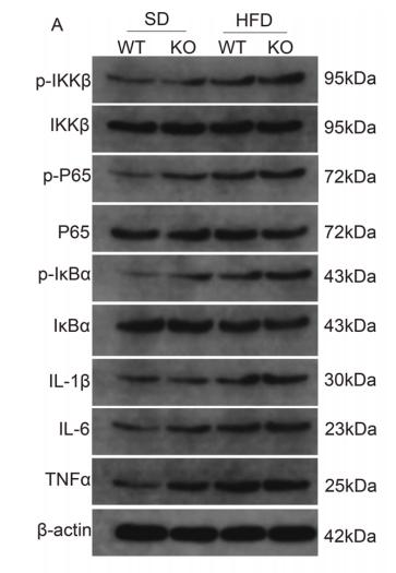 NF-kB p65 Antibody - Fig.
