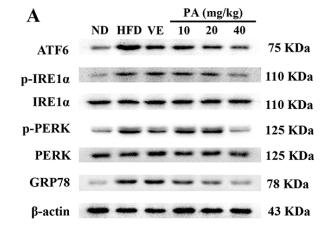 beta Actin Antibody - FIGURE 4 | PA treatment attenuated HFD-induced ER stress in rats.