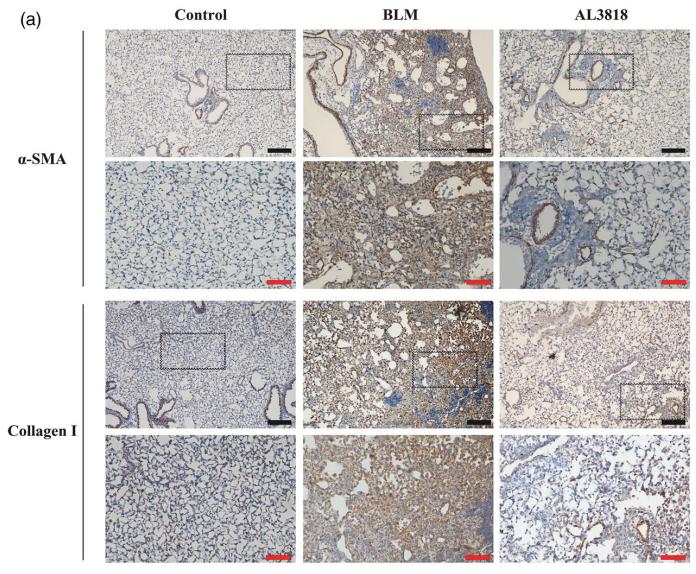 Collagen I Antibody - Figure3|(a)Immunohistochemistry for a-SMA and collagenI(Brownarea) in bleomycin-induced pulmonary fibrosis in mice on day 14.