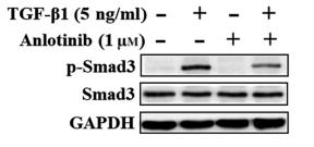 GAPDH Antibody - Figure5|Anlotinib antagonizes TGF-b1-mediated Smad and non-Smad signalling.