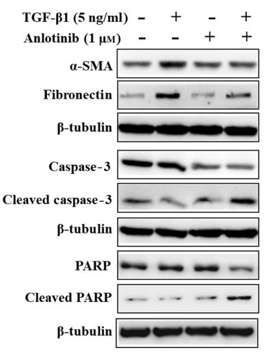 Tubulin alpha Antibody - Figure 7 |Anlotinib inhibits lung fibroblast excitation and promotes apoptosis.