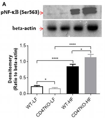 NF-kB p65 Antibody - FIGURE 6 | CD47 deficiency promotes HFD-induced nuclear factor-κB (NF-κB) activation and translocation.