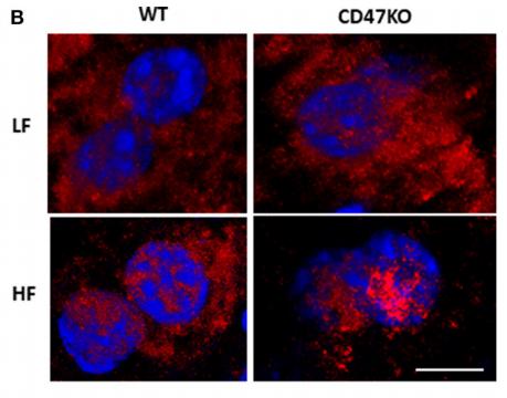 NF-kB p65 Antibody - FIGURE 6 | CD47 deficiency promotes HFD-induced nuclear factor-κB (NF-κB) activation and translocation.