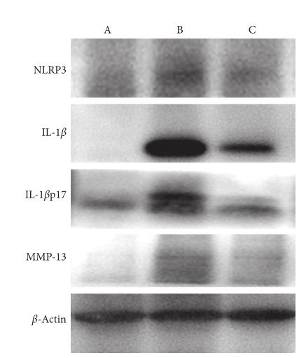 Cleaved-IL-1 beta (Asp116) Antibody - Figure 4:| The protein expression of NLRP3, IL-1β, IL-1β17p, and MMP-13 in the control group (A), saline group (B), and pranoprofen group (C) by performing western blot.
