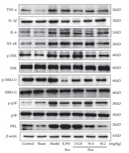 TNF alpha Antibody - Figure 5: |Western blot image of pituitary gland protein expressions in rats.