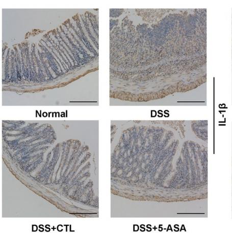 IL1 beta Antibody - Fig.