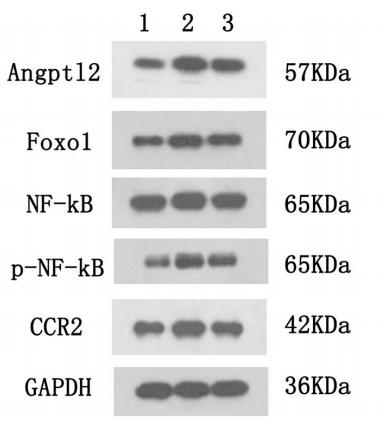 NF-kB p65 Antibody - Fig.