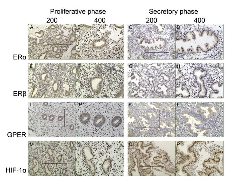 HIF1A Antibody - FIGURE 1| Expression and localization of oestrogen receptors and hypoxia-inducible factor-1alpha (HIF-1a) proteins in proliferative phase and secretary phase of normal control endometrium analysed by immunohistochemistry.