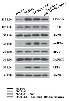 PERK Antibody - Supplementary figure 2.