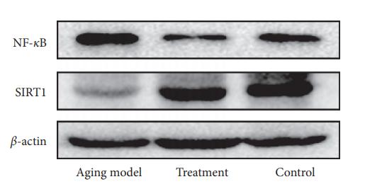 SirT1 Antibody - Figure 3: | 0e effects of LP on anti-inflammation in testicular tissue of aging rats via AMPK/SIRT1/NF-κB.