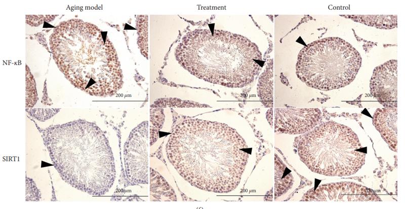 SirT1 Antibody - Figure 3: | 0e effects of LP on anti-inflammation in testicular tissue of aging rats via AMPK/SIRT1/NF-κB.