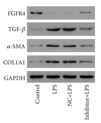 Collagen I Antibody - Figure 4:| The miR-7-5p inhibitor blocked LPS-induced LX-2 cell proliferation and activation.
