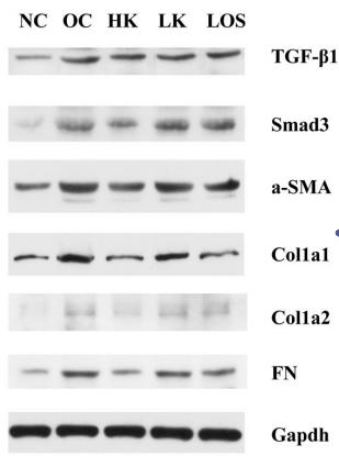 TGF beta 1 Antibody - Figure 2.