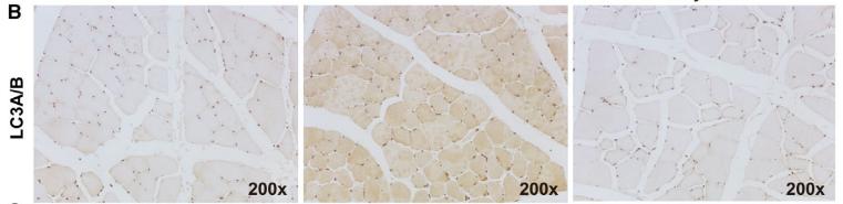 LC3A/B Antibody - FIGURE 4|Effect of calycosin on autophagy in muscle of 5/6 Nx rats.