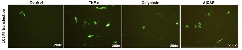LC3A/B Antibody - FIGURE 7|Effect of calycosin on myotube atrophy in TNF-α induced C2C12 cells in vitro.