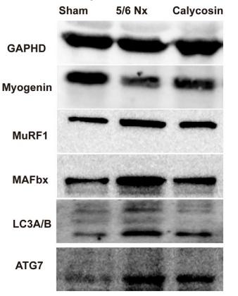 LC3A/B Antibody - FIGURE 5|Effect of calycosin on the expression of CARM1 and H3R17me2a,and related proteins in rat muscles.