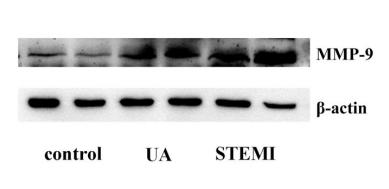 MMP9 Antibody - FIGURE 3 |Expression of NEAT1,miR-204, and MMP-9 in exosomes of the control, UA, and STEMI groups.