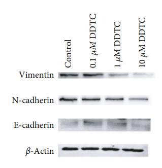 N Cadherin Antibody - Figure 3:| The effect of DDTC on the EMT in ovarian cancer cells.