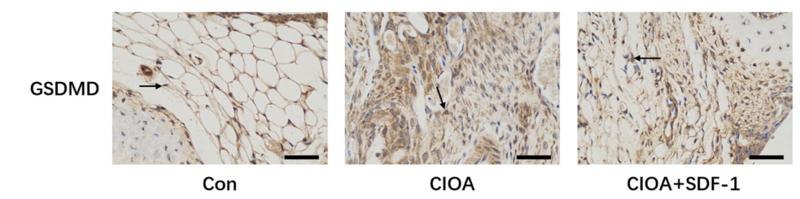 GSDMD Antibody - Fig.
