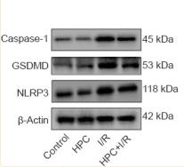 GSDMD Antibody - Figure 6
Effect of HPC on the expression of caspase-1, GSDMD, and NLRP3 in the brains of cerebral I/R injury model mice.