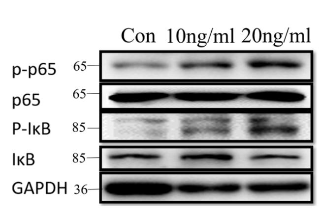 NF-kB p65 Antibody - Figure 6.