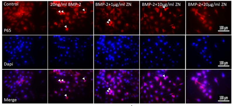 NF-kB p65 Antibody - Figure 6.
