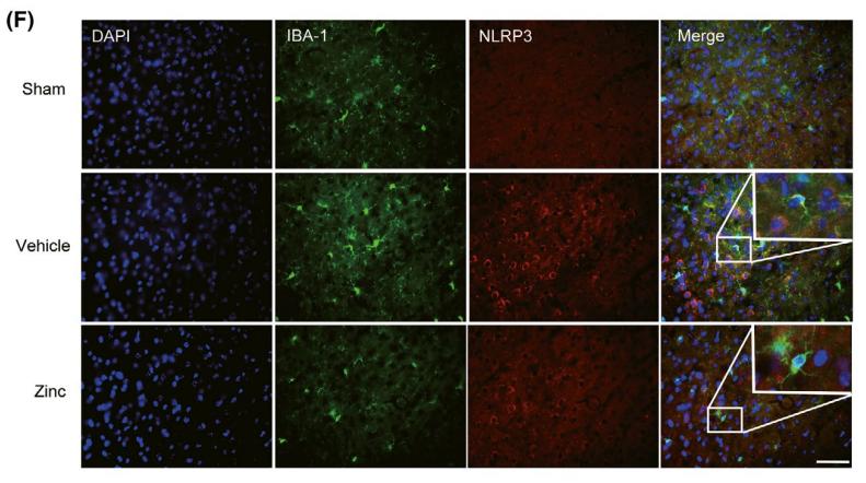 NLRP3 Antibody - FIGURE 4 |Treatment with zinc suppresses the NLRP3 inflammasome after SCI Mice were sacrificed on the third day after zinc administration.