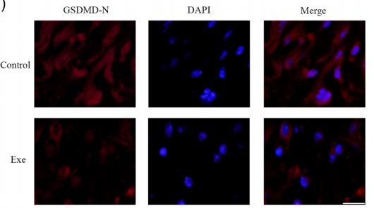 GSDMD Antibody - FIGURE 4 | Exenatide mitigates pyroptosis.