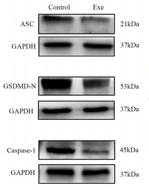 GSDMD Antibody - FIGURE 4 | Exenatide mitigates pyroptosis.