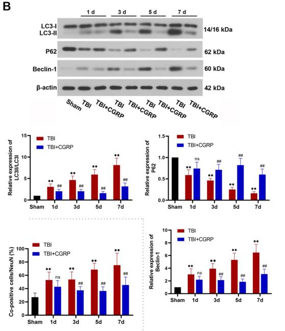 LC3A/B Antibody - Fig.