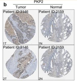 PKP2 Antibody - Fig.