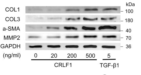Collagen I Antibody - FIGURE 4 | CRLF1 stimulates the cell matrix at the post-transcriptional level.