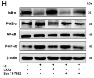 NF-kB p65 Antibody - Fig.