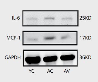 IL6 Antibody - Fig.