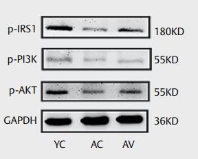 Phospho-AKT1/2/3 (Ser473) Antibody - Fig.