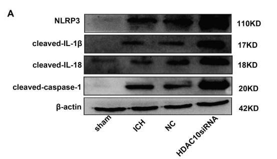 Cleaved-IL-1 beta (Asp116) Antibody - Fig.