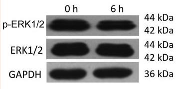 ERK1/2 Antibody - Figure 8
HSYA reduces the ratio of p-ERK1/2 to total ERK1/2 in Hep-G2 cells.