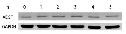 VEGFA Antibody - Fig 2.