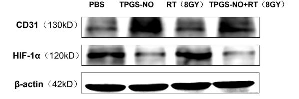 HIF1A Antibody - Fig.