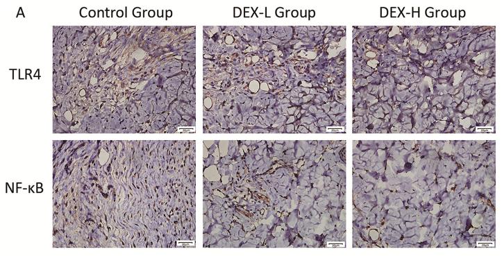 NF-kB p65 Antibody - Fig.
