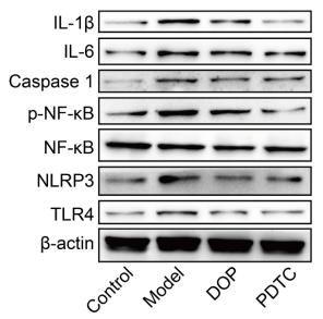 Cleaved-IL-1 beta (Asp116) Antibody - Fig.