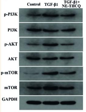 Phospho-AKT1/2/3 (Ser473) Antibody - Figure 6
Experimental validation of the key signaling pathways in vitro.