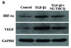 HIF1A Antibody - Figure 6
Experimental validation of the key signaling pathways in vitro.
