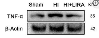 TNF alpha Antibody - Figure 2
Treatment with liraglutide decreased the inflammatory response at both the mRNA and protein levels.