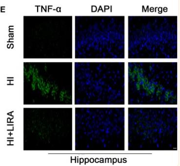 TNF alpha Antibody - Figure 2
Treatment with liraglutide decreased the inflammatory response at both the mRNA and protein levels.