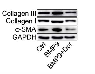 Collagen I Antibody - Figure 4.