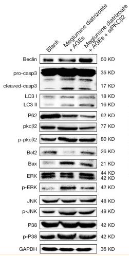 Bcl-2 Antibody - Figure 4
PKCβ2 knockdown alleviates meglumine diatrizoate and AGEs-induced HK-2 cell apoptosis.