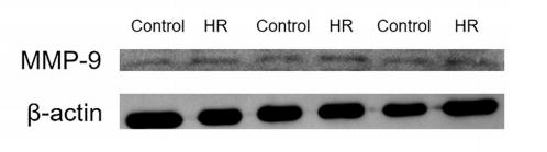 MMP9 Antibody - Figure 4.